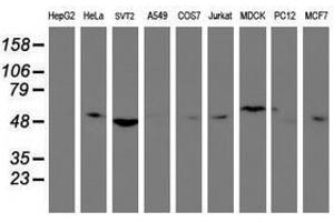 Image no. 2 for anti-Tubby Like Protein 3 (TULP3) antibody (ABIN1501586)