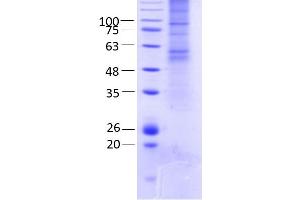 Image no. 2 for Gap Junction Protein, gamma 2, 47kDa (GJC2) (AA 1-439) protein (rho-1D4 tag) (ABIN3078600)