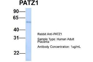 Image no. 3 for anti-Zinc Finger Protein 278 (ZNF278) (N-Term) antibody (ABIN2779693)
