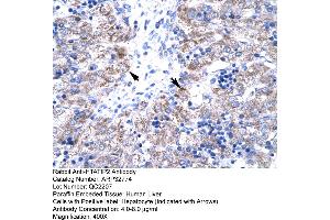 Image no. 3 for anti-HIV-1 Tat Interactive Protein 2, 30kDa (HTATIP2) (N-Term) antibody (ABIN2777583)