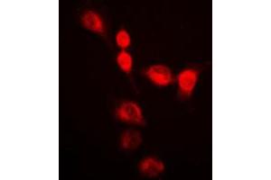 Image no. 1 for anti-Single-Strand-Selective Monofunctional Uracil-DNA Glycosylase 1 (SMUG1) (Center) antibody (ABIN2707077)