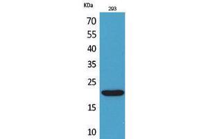Image no. 1 for anti-CKLF-Like MARVEL Transmembrane Domain Containing 6 (CMTM6) (C-Term) antibody (ABIN3187825)