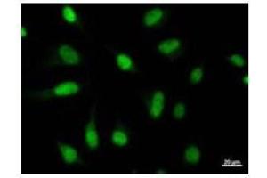 Image no. 1 for anti-V-Myb Myeloblastosis Viral Oncogene Homolog (Avian)-Like 2 (MYBL2) antibody (ABIN933092)