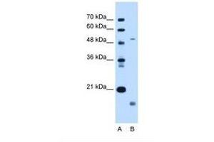 Image no. 1 for anti-Zinc Metalloproteinase, Ste24 (Zmpste24) (AA 83-132) antibody (ABIN6738260)