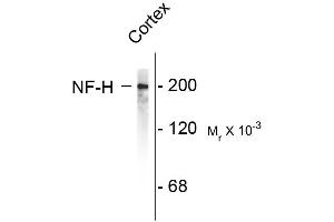 Image no. 1 for anti-Neurofilament, Heavy Polypeptide (NEFH) antibody (ABIN361351)