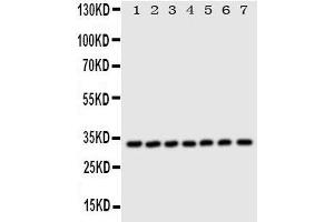 Image no. 3 for anti-Enoyl-CoA Delta Isomerase 1 (ECI1) (AA 272-290), (C-Term) antibody (ABIN3044153)