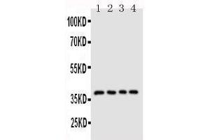 Image no. 1 for anti-CD1d Molecule (CD1D) (AA 76-92), (N-Term) antibody (ABIN3044081)
