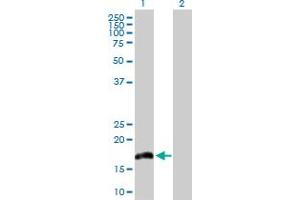 Image no. 1 for anti-Interleukin 20 (IL20) (AA 1-176) antibody (ABIN526310)