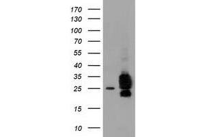 Image no. 12 for anti-ClpP Caseinolytic Peptidase, ATP-Dependent, Proteolytic Subunit Homolog (E. Coli) (CLPP) antibody (ABIN1497535)