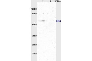 Image no. 3 for anti-Autophagy Related 13 (ATG13) (AA 51-150) antibody (ABIN750313)