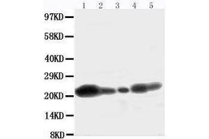 Image no. 1 for anti-Caveolin 1, Caveolae Protein, 22kDa (CAV1) (AA 164-178), (C-Term) antibody (ABIN3044427)