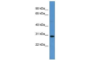 Western Blot showing SPRED2 antibody used at a concentration of 1-2 ug/ml to detect its target protein.