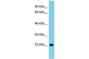 Image no. 1 for anti-V-Ral Simian Leukemia Viral Oncogene Homolog B (Ras Related, GTP Binding Protein) (Ralb) (Middle Region) antibody (ABIN2786741)