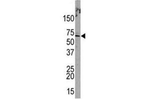 Image no. 3 for anti-Promyelocytic Leukemia (PML) (AA 470-499), (Sumoylation Site) antibody (ABIN3032330)