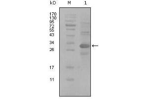 Image no. 1 for anti-Activated Leukocyte Cell Adhesion Molecule (ALCAM) (AA 405-524) antibody (ABIN1724709)