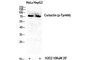 Image no. 2 for anti-Cortactin (CTTN) (pTyr466) antibody (ABIN3182724)