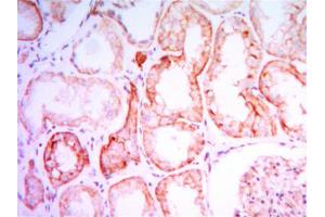 Image no. 1 for anti-Parathyroid Hormone 1 Receptor (PTH1R) antibody (ABIN969372)