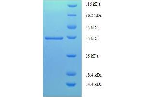 PTGDS Protein (AA 23-190) (His-SUMO Tag)