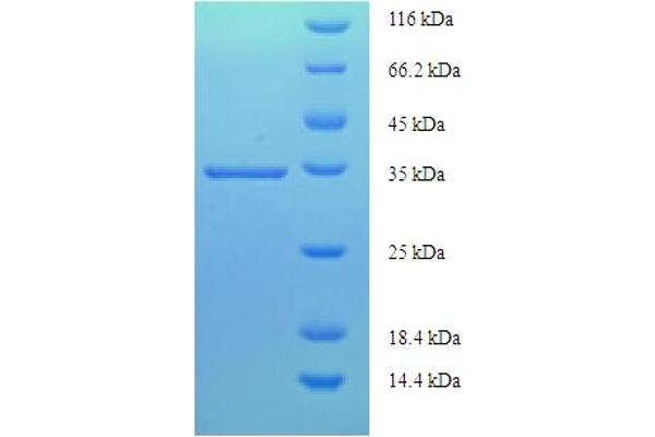 PTGDS Protein (AA 23-190) (His-SUMO Tag)