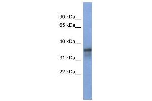 Image no. 2 for anti-RNA Binding Motif Protein 9 (RBM9) (Middle Region) antibody (ABIN2779058)