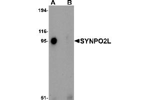 Image no. 2 for anti-Synaptopodin 2-Like (SYNPO2L) (N-Term) antibody (ABIN1031594)