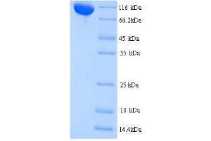 Image no. 1 for CCCTC-Binding Factor (Zinc Finger Protein)-Like (CTCFL) (AA 1-636), (full length) protein (His tag) (ABIN5713384)