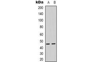 Image no. 2 for anti-Proteasome (Prosome, Macropain) 26S Subunit, Non-ATPase, 11 (PSMD11) antibody (ABIN2801313)