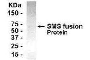 Image no. 1 for anti-Spermine Synthase, SMS (SMS) (AA 206-335) antibody (ABIN2467922)