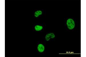 Image no. 2 for anti-Nuclear Cap Binding Protein Subunit 1, 80kDa (NCBP1) (AA 1-790) antibody (ABIN518206)