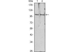 Image no. 1 for anti-Histone Deacetylase 4 (HDAC4) antibody (ABIN969190)