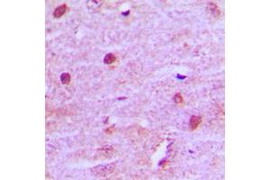Image no. 1 for anti-Menage A Trois Homolog 1, Cyclin H Assembly Factor (Xenopus Laevis) (MNAT1) (Center) antibody (ABIN2706576)