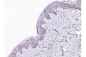 Image no. 1 for anti-Parathyroid Hormone (PTH) (AA 32-65) antibody (ABIN2692875)