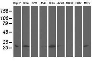Image no. 3 for anti-Adenylate Kinase 4 (AK4) antibody (ABIN1496524)