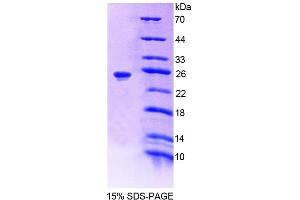 Image no. 1 for Alanine Glyoxylate Aminotransferase (AGXT) (AA 182-371) protein (His tag) (ABIN6239079)