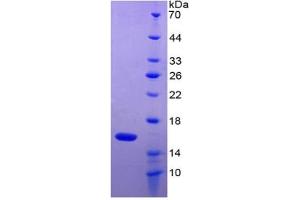 Image no. 3 for Growth Differentiation Factor 2 (GDF2) ELISA Kit (ABIN6730862)