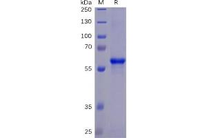Image no. 2 for SARS-CoV-2 Spike (RBD) protein (mFc Tag,His tag) (ABIN6961147)