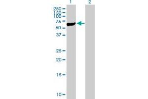 Western Blot analysis of STK40 expression in transfected 293T cell line by STK40 MaxPab polyclonal antibody.