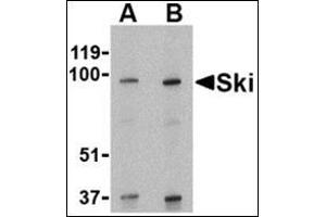 SKI antibody  (N-Term)