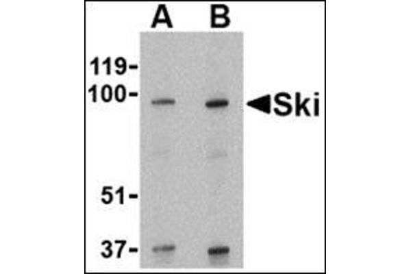 SKI antibody  (N-Term)
