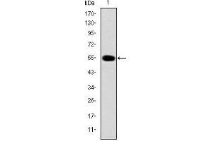 Image no. 2 for anti-Interleukin-1 Receptor-Associated Kinase 4 (IRAK4) antibody (ABIN1107881)