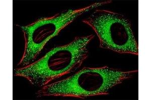 Fluorescent image of HeLa cells stained with FGFR2 antibody at 1:25 dilution.