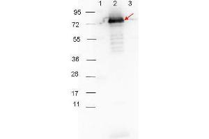 Western Blotting (WB) image for anti-Surface Lipoprotein p27 antibody (ABIN964724)
