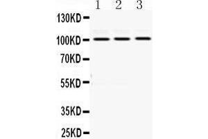 Image no. 1 for anti-RAS P21 Protein Activator (GTPase Activating Protein) 1 (RASA1) (AA 1018-1047), (C-Term) antibody (ABIN3043368)