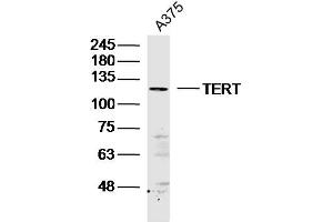 Image no. 5 for anti-Telomerase Reverse Transcriptase (TERT) (AA 601-750) antibody (ABIN726650)