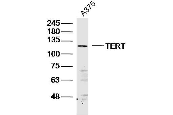 TERT antibody  (AA 601-750)