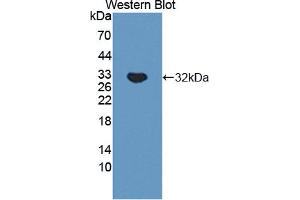 Image no. 1 for anti-Tenascin XB (TNXB) (AA 3824-4071) antibody (ABIN5014390)
