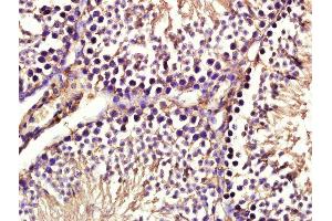 Image no. 1 for anti-Anterior Pharynx Defective 1 Homolog B (Aph1b) (AA 51-150) antibody (ABIN1386275)