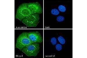 Image no. 1 for anti-ATP-Binding Cassette, Sub-Family A (ABC1), Member 4 (ABCA4) (AA 2250-2263) antibody (ABIN343052)