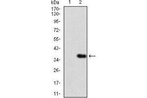 Image no. 5 for anti-Interleukin 3 Receptor, alpha (Low Affinity) (IL3RA) (AA 200-305) antibody (ABIN1724855)