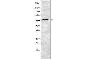 Image no. 1 for anti-TSPY-Like 2 (TSPYL2) (Internal Region) antibody (ABIN6256858)